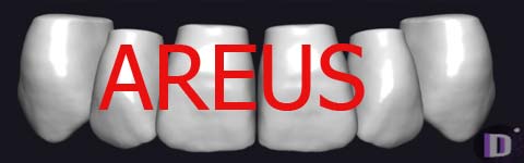 AREUS_prev1 دانلود AREUS