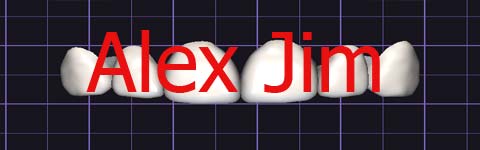 Alex_Jim_prev1