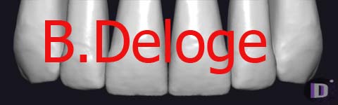 B.Deloge_prev1 دانلود B.Deloge