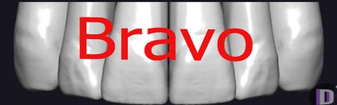 Bravo_prev1