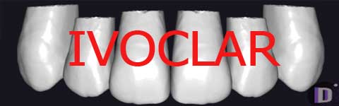 IVOCLAR_prev1