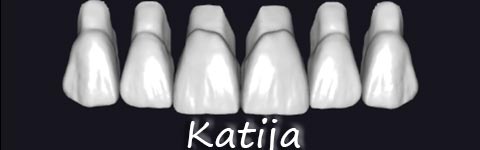 KatijaTeeth1