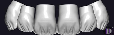 PDL_CatBackTeeth