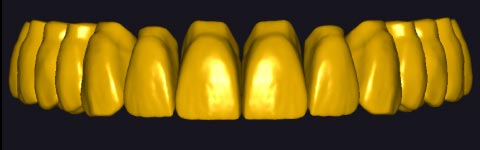 PetraTeeth1