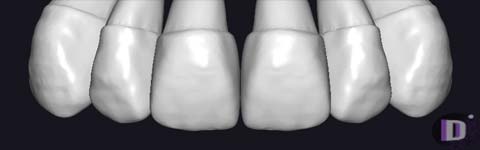 Teethcollection1_prev1