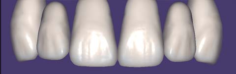 Teethcollection1_prev1