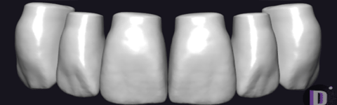 Teethcollection2_prev1 دانلود Teethcollection2