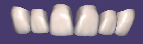 Teethcollection2_prev1 دانلود Teethcollection2