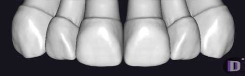 Teethcollection3_prev1