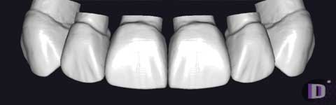 Teethcollection3_prev1