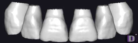 Teethcollection4_prev1