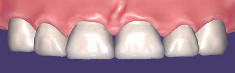 Teethcollection4_prev1