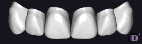 Teethcollection5_prev1