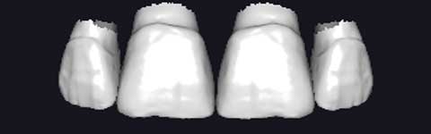 Teethcollection5_prev1
