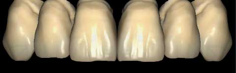 Teethcollection6_prev1