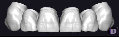 Teethcollection6_prev1