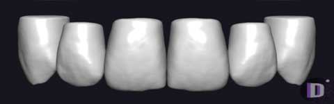 Teethcollection7_prev1 دانلود Teethcollection7