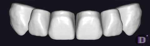 Teethcollection8_prev1