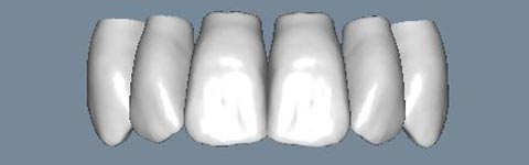 ZirkonTeeth1