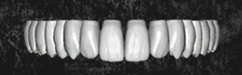 ZirkonTeeth1